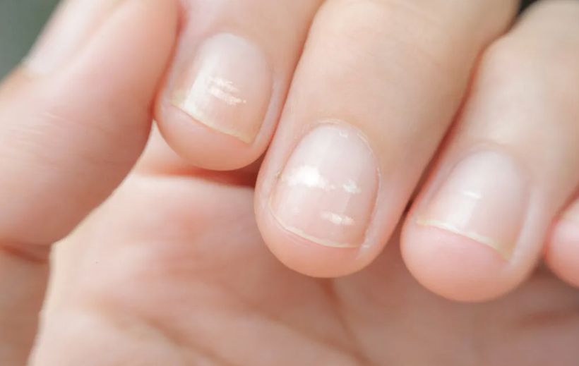 7 Foods to Eat for Strong and Healthy Nails