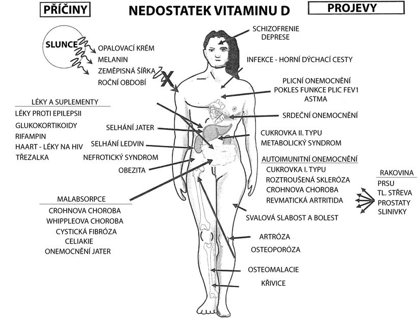 Nedostatkem vitamínu D trpí až miliarda lidí. Víte, co vám hrozí?