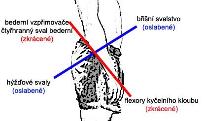 5 nejlepších cviků pro pevný zadek, které zvládneš v každé posilovně