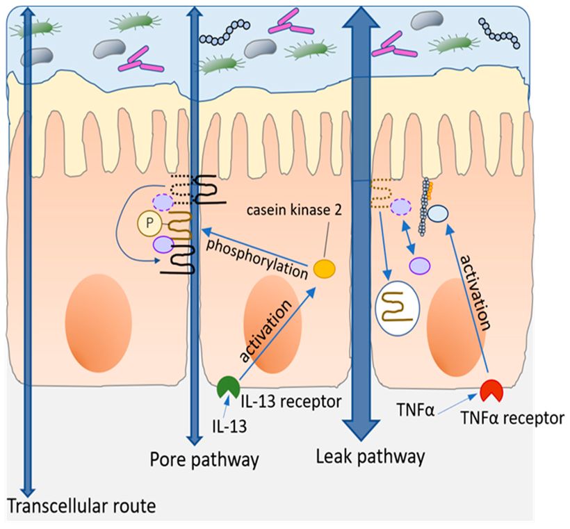 Leaky-gut syndrom aneb zvýšená propustnost střev