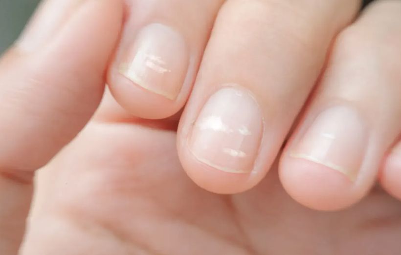 Význam kremeliny: Môže byť prospešná pre ľudský organizmus?