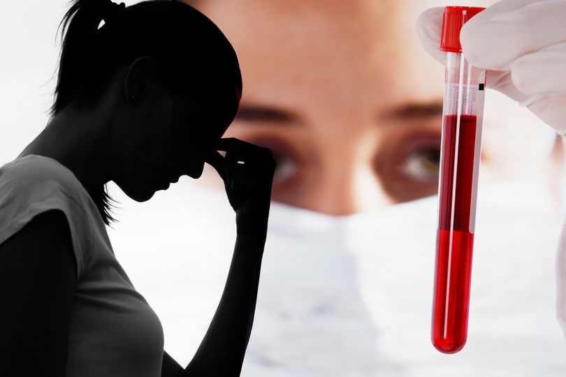 Krvné testy ukazujú zlyhanie obličiek? Hodnoty skresľuje kreatín aj fyzická aktivita
