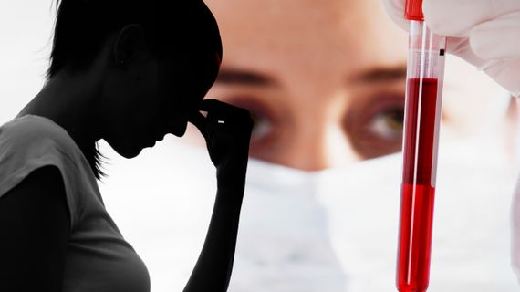 Krvné testy ukazujú zlyhanie obličiek? Hodnoty skresľuje kreatín aj fyzická aktivita